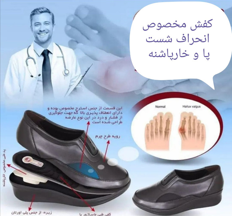 هالوکس والگوس