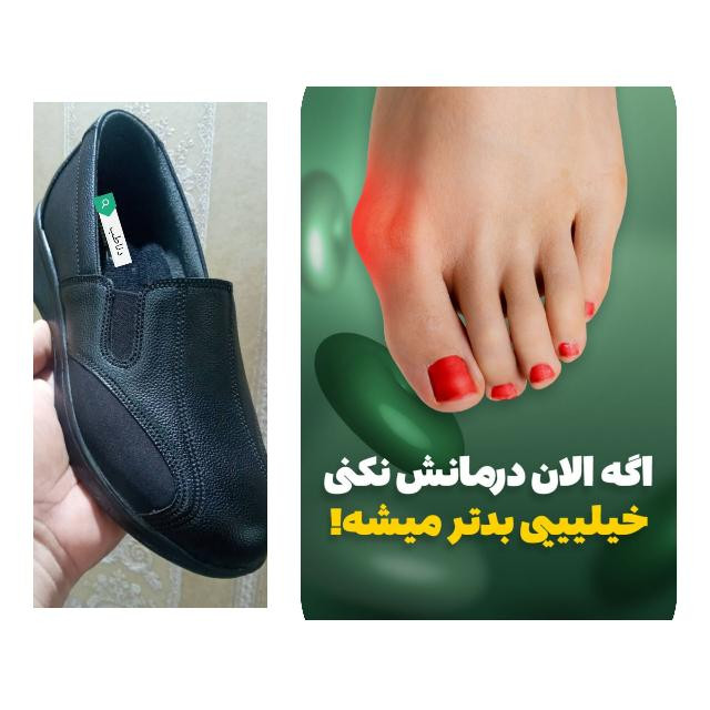کفش انحراف انگشت شست