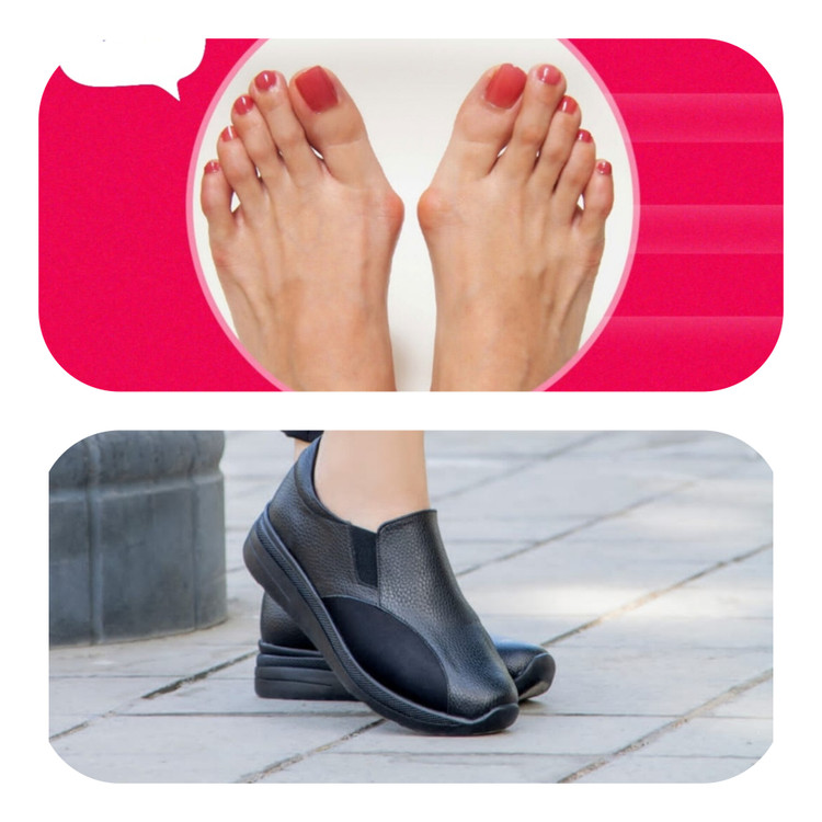 کفش هالوکس والگوس و انحراف شست پا